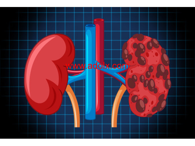 Diabetes and Kidney Disease: Understanding the Connection and Prevention