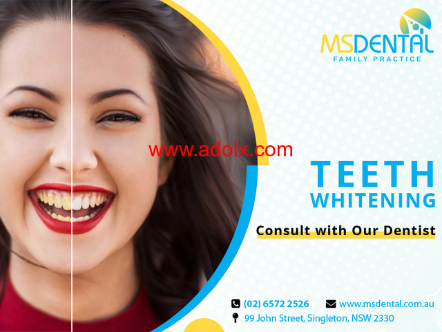 High Quality Teeth Whitening Treatment In Singleton – Ms Dental Singleton