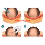 Looks Hair and Skin Clinic